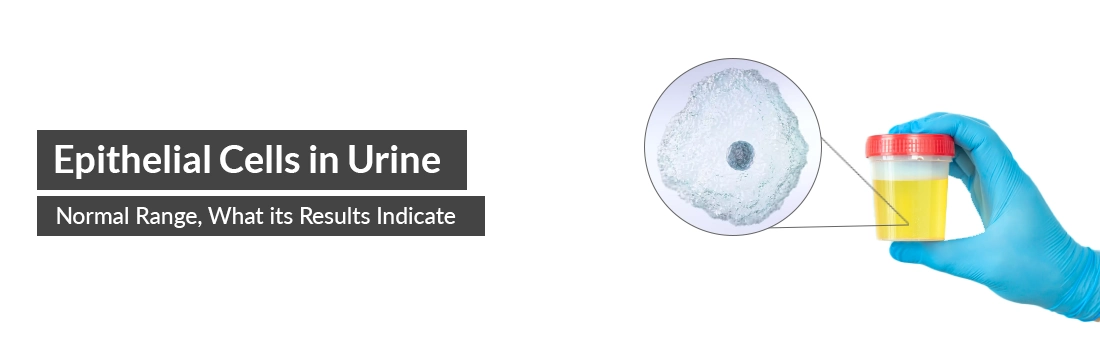  Epithelial Cells in Urine: Normal Range, What Its Results Indicate